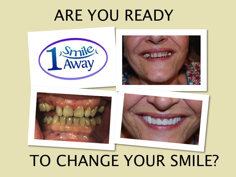 snap on smile showcase